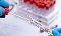 مروری بر سندرم تنفس خاورمیانه کورونا ویروس مرس (MERS)